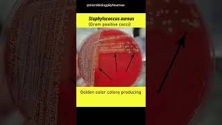 Staphylococcus aureus on Blood agar plate shorts youtubeshorts [upl. by Aikenat]