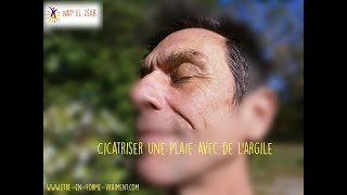 De largile pour soigner une plaie  estce raisonnable [upl. by Lladnek]