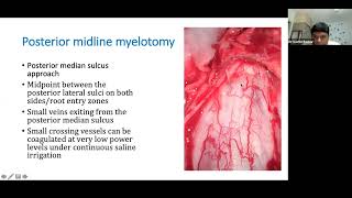 PAEDIATRIC NEUROONCOLOGY  Spine [upl. by Aineg]