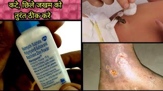 Neosporin power uses in hindi पसीने की खुजलीइन्फेक्शन [upl. by Sara-Ann]