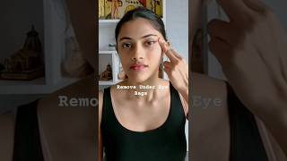 Best Treatment for Under Eye Bags 👆🏼watch full video skincare shorts facemassage [upl. by Letisha133]