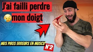 JAI FAILLI PERDRE UN DOIGT À CAUSE DE ZYZZ [upl. by Solon]