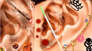 Ear Piercing Cleaning ASMR  Ear Cleaning ASMR Animation  Ear Infection Treatment ASMRidhu [upl. by Base]