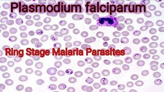 Plasmodium falciparum under microscope [upl. by Souza419]