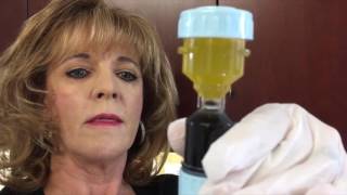 How to prepare Platelet Rich Plasma [upl. by Ysak]