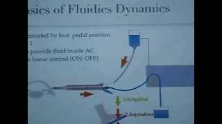 The Basic Phaco Machine 1 [upl. by Holcomb]