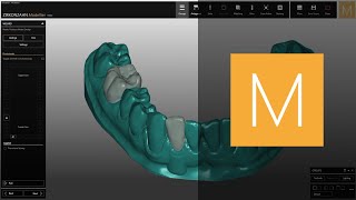 How to create a model with temporary crowns in ZirkonzahnModellier  ZirkonzahnSoftware [upl. by Ward981]