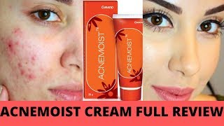 ACNEMOIST CREAM FULL REVIEW BEST CREAM FOR ACNE PRONE SKIN पिम्पल्स वाले लोगो के लिए बेस्ट क्रीम [upl. by Rastus]