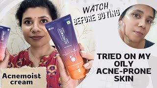 Acnemoist cream honest review  Is it safe does it work on acneprone skin [upl. by Inva]