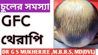 চুলের সমস্যা  Hair Fall Problem  Alopecia PRP Therapy Dr G S Mukherjee [upl. by Car]