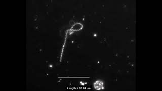 Interaction of Treponema pallidum the syphilis spirochete with human platelets [upl. by Amaleta]