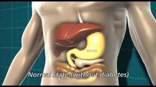 Diabetes and the body  Diabetes UK [upl. by Birkle]