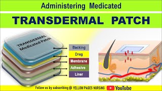 Transdermal Medicated patch  Transdermal patch  Transdermal Drug Delivery TDD  Made Easy [upl. by Nimar]