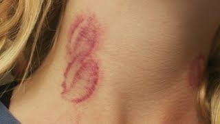 how to give someone a hickey on the neck fast tutorial [upl. by Darn]