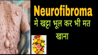 neurofiboma में खट्टा खाने के लिए क्यों मना किया जाता है खट्टा आपकी बॉडी में क्या करता है viral [upl. by Frayne553]