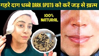 सिर्फ 1 हफ्ता लगायेझाइयां दाग धब्बेDARK SPOTS 100 गायबपाये जादुई निखार Hyperpigmentation Remedy [upl. by Gawain]