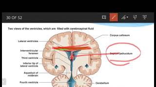 Lecture 4 precuneus and corpus collosum [upl. by Haem]