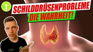 Schilddrüsenprobleme die Wahrheit❗ WARUM DU Schilddrüsenprobleme hast❗ KLARTEXT❗ [upl. by Yuu]