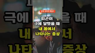 피곤이 극에 달했을때 내 몸에서 나타나는 증상 피로회복 건강정보 [upl. by Leventis477]