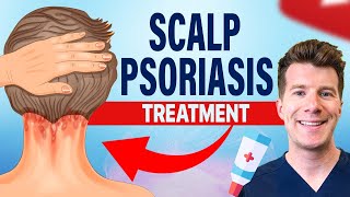 Doctor explains FOUR TREATMENTS for SCALP PSORIASIS [upl. by Hairahs]