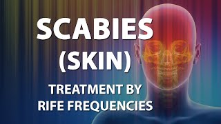 Scabies Skin  RIFE Frequencies Treatment  Energy amp Quantum Medicine with Bioresonance [upl. by Leeth587]