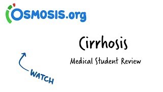 Cirrhosis Overview  Clinical Presentation [upl. by Coyle]