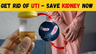 Painful Urination  Urinary Tract Infection  How to Diagnose UTI  Improve Kidney Health [upl. by Nerrat]