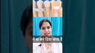 Pulpectomy  Pulpectomy in Children  Primary deciduous tooth treatment  दूधिया दांत उपचार [upl. by Yelsnya]