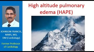 High altitude pulmonary edema HAPE [upl. by Nollaf]