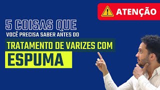 5 coisas que você precisa saber antes de tratar as varizes com espuma varizes espuma [upl. by Irabaj]