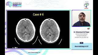 Emirates Neurology Virtual Congress 46 February 2021  Dr Mohammed Asif Dogar [upl. by Stickney654]