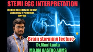 Stemi ecg interpretation  ecg localization of stemi  Mi ecg  neetpg fmge neet mbbs aiims [upl. by Nolaj520]