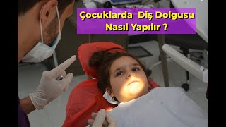 Çocuklarda Diş Dolgusu Nasıl Yapılır   How Is Tooth Filling Done In Children [upl. by Ayouqes]