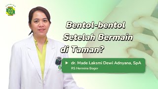 Urtikaria  Gimana si cara cegah bentolbentol pada anak   Part 2 [upl. by Rayna747]