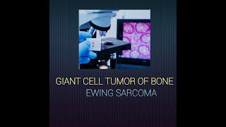 Giant cell tumor of bone amp Ewing sarcoma giantcelltumor ewingsarcoma systemicpathology [upl. by Eannyl]