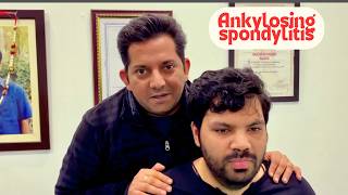 Ankylosing Spondylitis Treatment Severity Story  Dr Jeetu Mishra [upl. by Fenton]