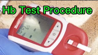 How to check hemoglobin level [upl. by Lula]