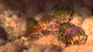 Cancer Cells Undergoing Mitosis [upl. by Coridon168]