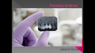 Anomalias dentárias [upl. by Som]