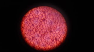 REAL LENTICELS and STOMATA [upl. by Luar]