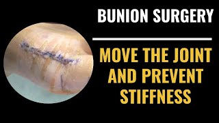 Recovering after bunion surgery how to move the joint and prevent stiffness [upl. by Annaxor]