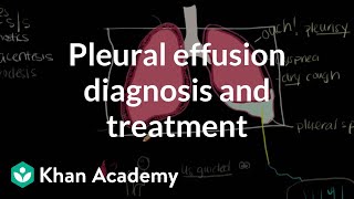 Pleural effusion diagnosis and treatment  Respiratory system diseases  NCLEXRN  Khan Academy [upl. by Animlehliw876]