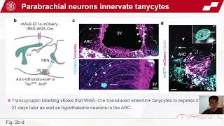 JC131 brainstemhypothalamus neuronal circuit reduces feeding upon heat exposureHuang Shang Yuan [upl. by Jeff]