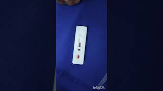 Malaria test in emergency ward emergency duty hospital nursing doctor subscribe mbbs [upl. by Elimaj439]