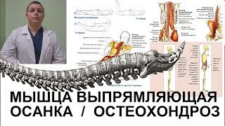 Мышца выпрямляющая Упражнения Исправить Осанку Боль в спине [upl. by Hilda]