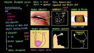 What is Herpes [upl. by Aivilys]