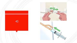 Foley Catheter Flush [upl. by Filippo290]