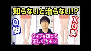 【O脚矯正】O脚？XO脚？タイプと改善方法を超簡単に解説 [upl. by Gregor]