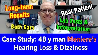 Case Study 48 y man Ménières disease Hearing Loss Dizziness long term treatment results [upl. by Annovy]