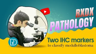 Two IHC markers to classify medulloblastoma [upl. by Aisatsana]